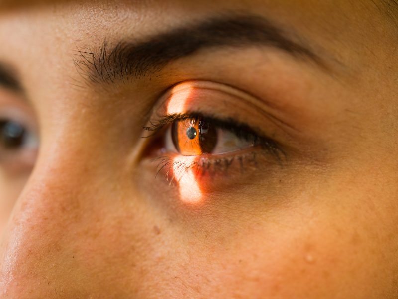 Abril Marrom alerta para doenças silenciosas que podem causar perda irreversível da visão