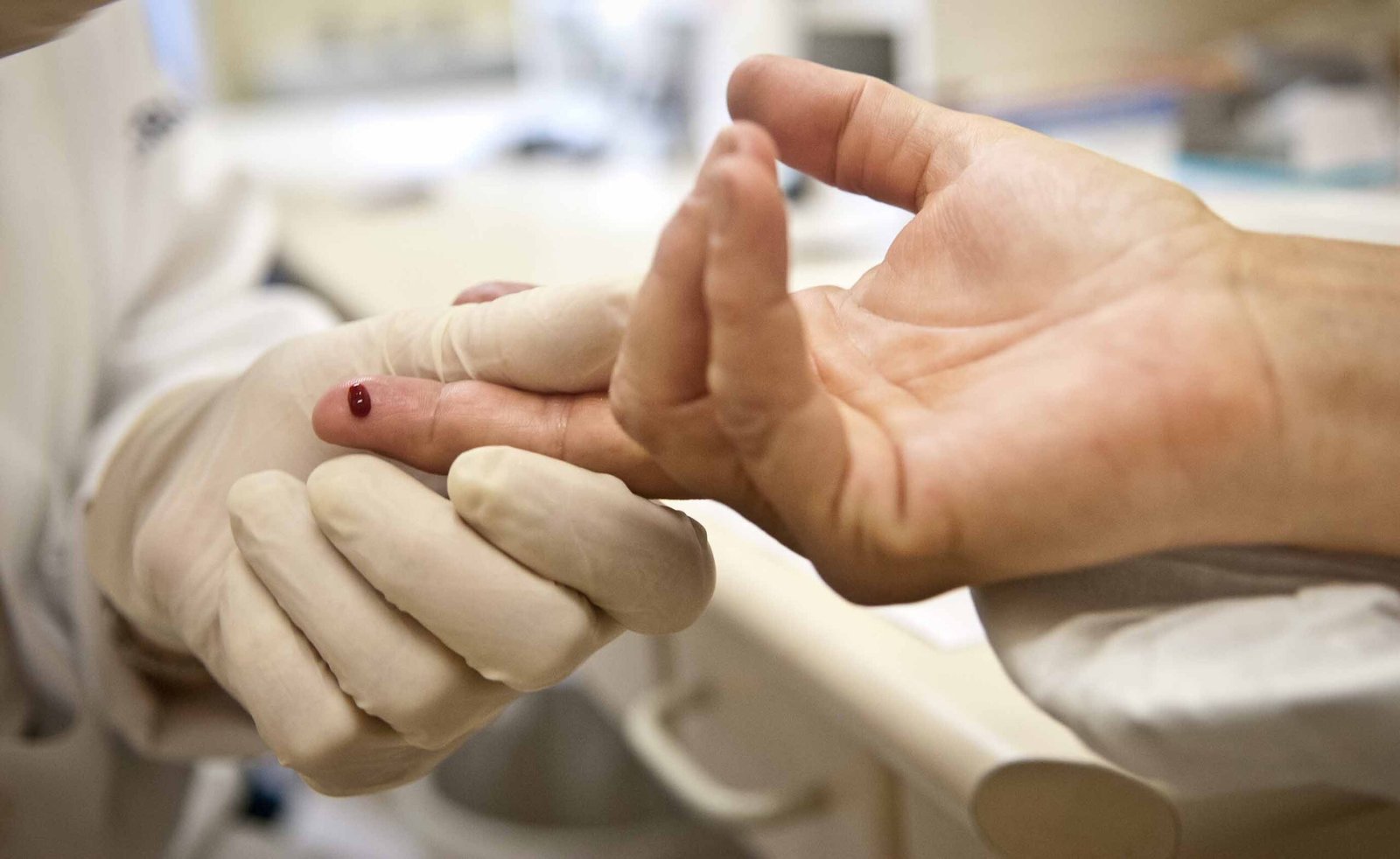 Angra reforça a importância dos testes rápidos de hepatites virais durante o Julho Amarelo