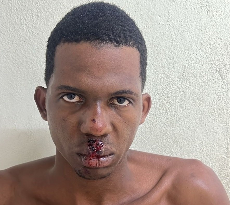 Luiz Maxter Nascimento Teixeira